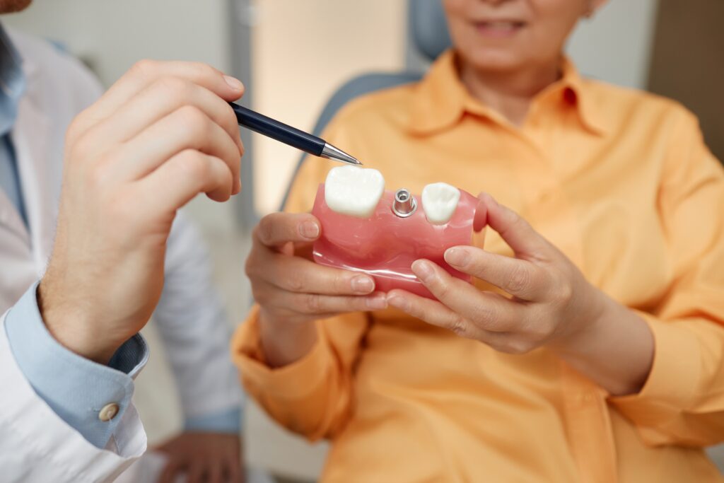 after care for dental implants